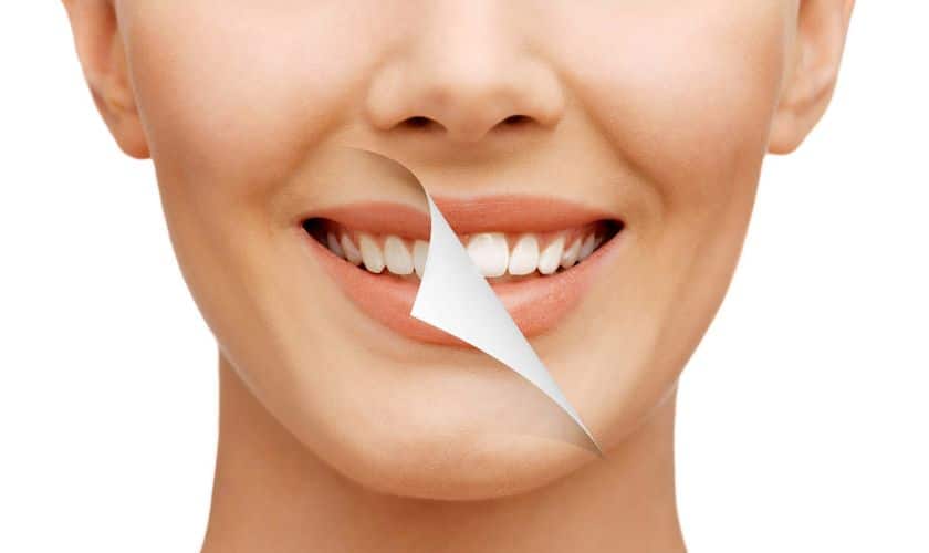 Celebrity Smile Secrets Revealed How Your Favorite Stars Maintain Their Picture-Perfect Grins